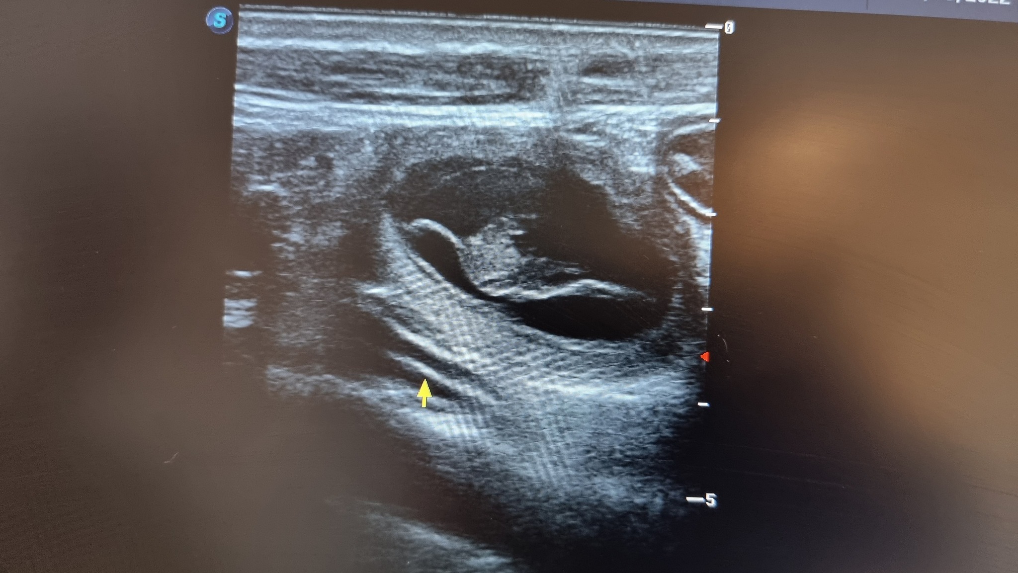 We are expecting puppies